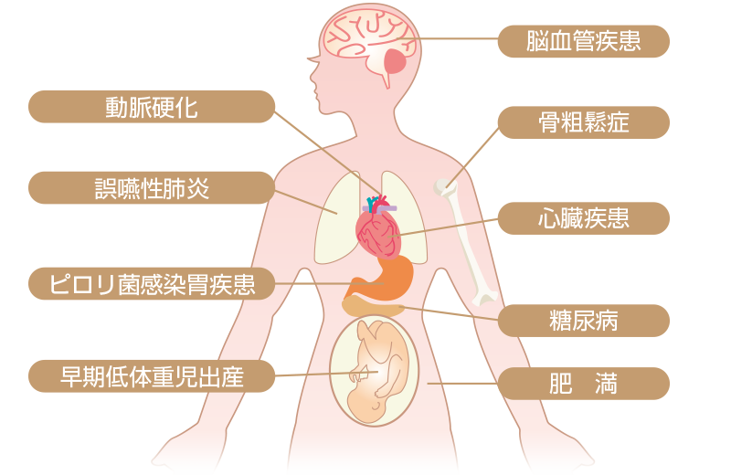 歯周病と全身疾患